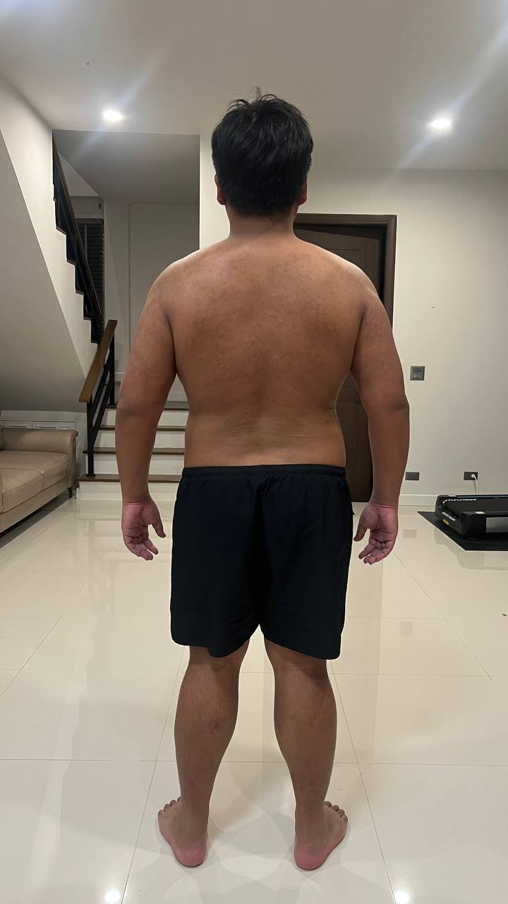 Back view